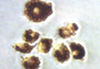 Phagocytosis